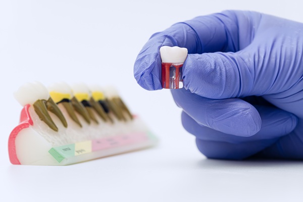 General Dentistry: How Dental Crowns Can Safeguard Your Teeth