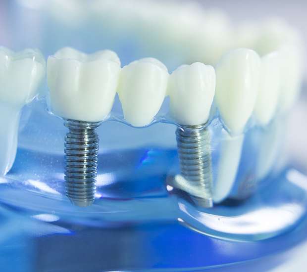 Fort Lee Dental Prosthetics