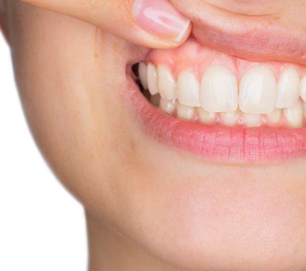 Fort Lee Gum Disease