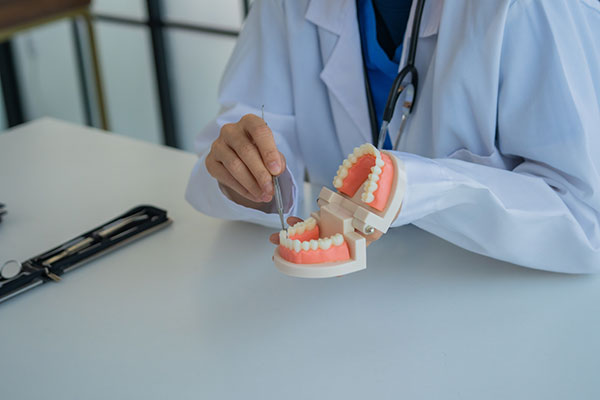 The Importance Of Implant Restoration