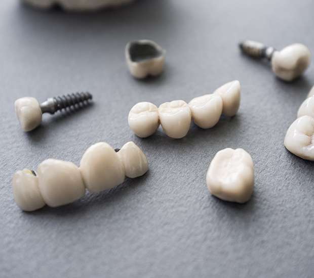 Fort Lee The Difference Between Dental Implants and Mini Dental Implants