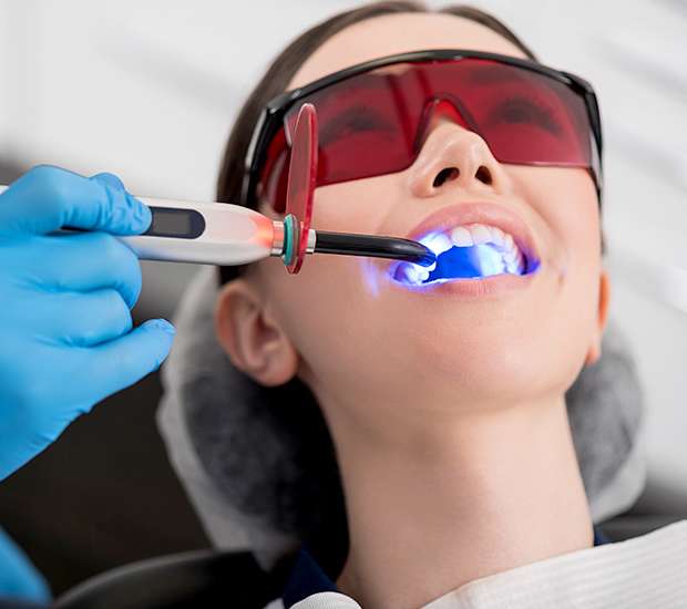 Fort Lee Professional Teeth Whitening
